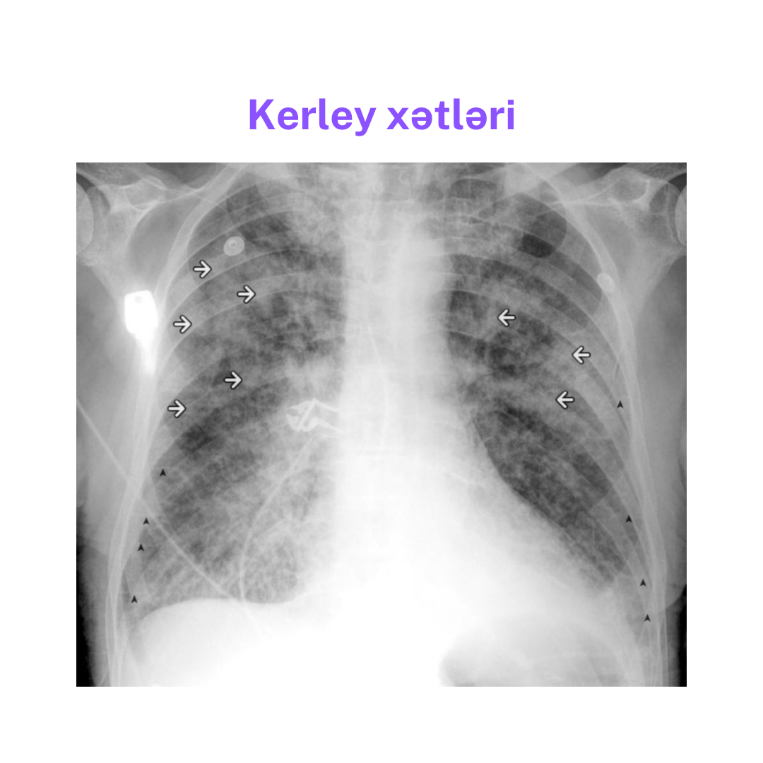 kerley1.png