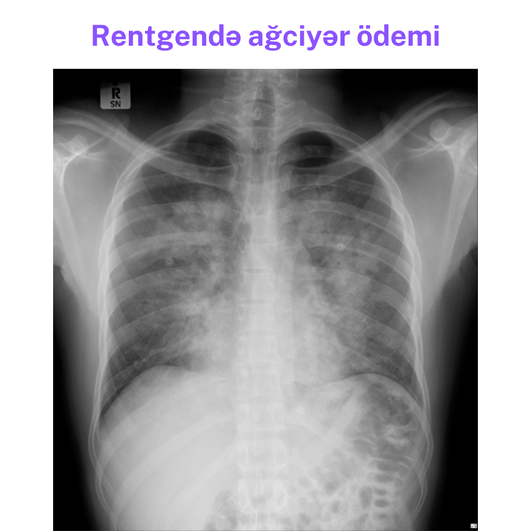 odem.png