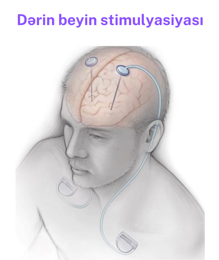 parkinson-1.png