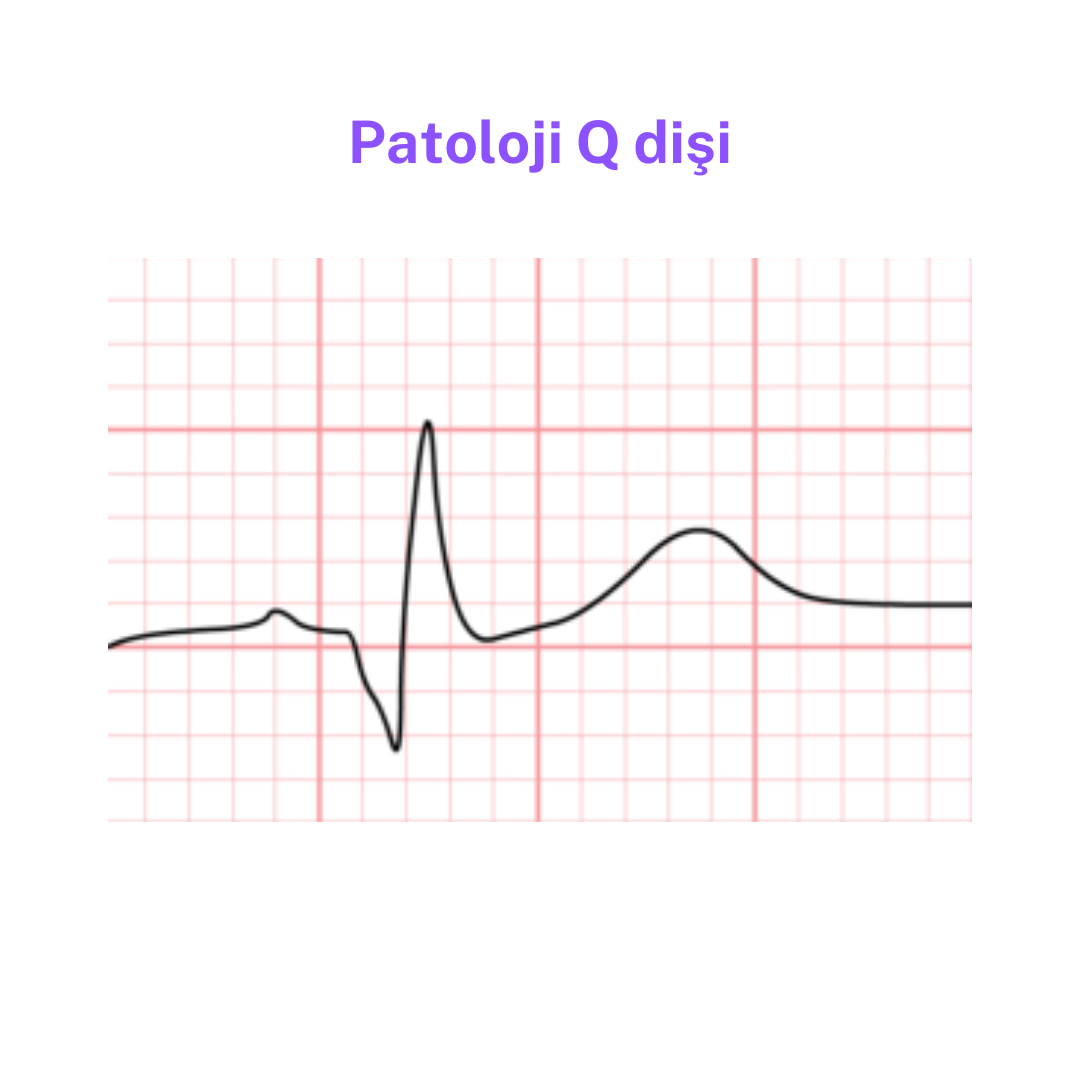 patolojiq.png