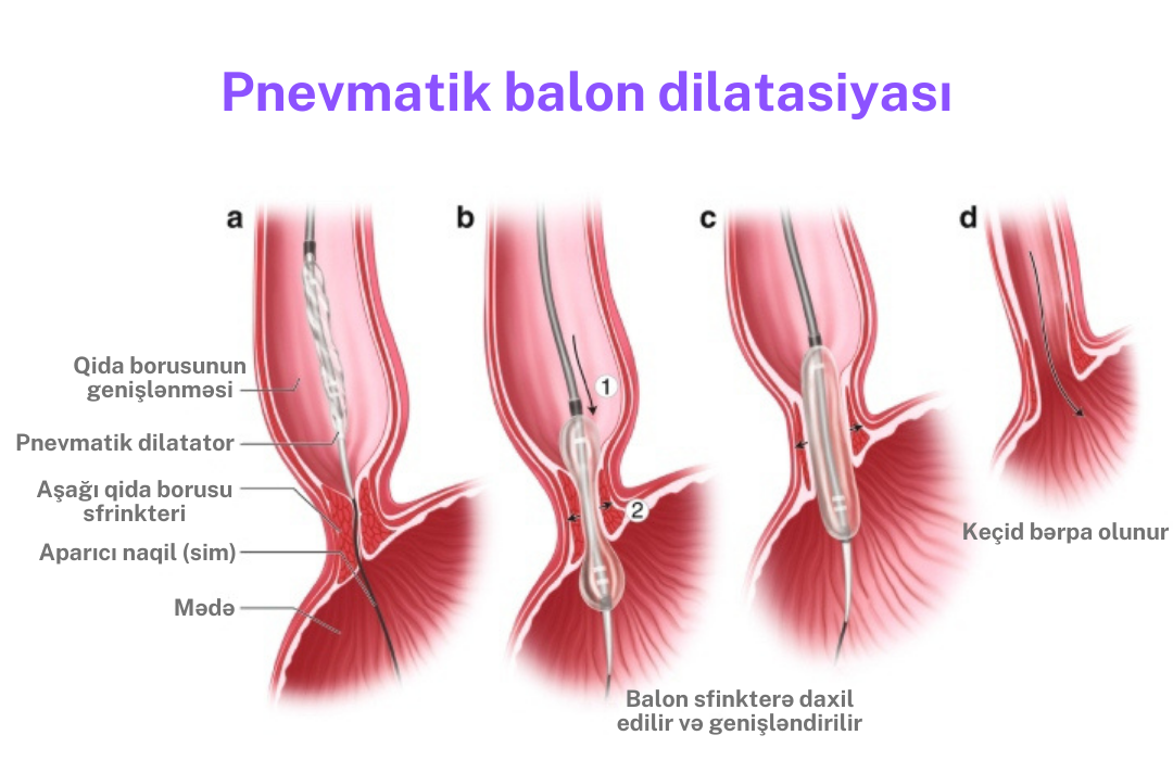 pnevmatik-balon.png